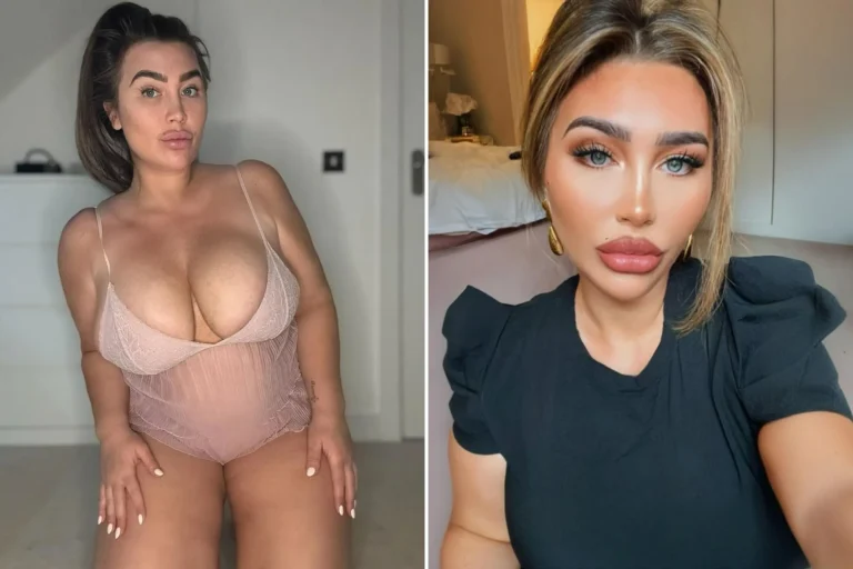 Lauren Goodger Opens Up: Why She's Reversing Surgery for a Natural Look