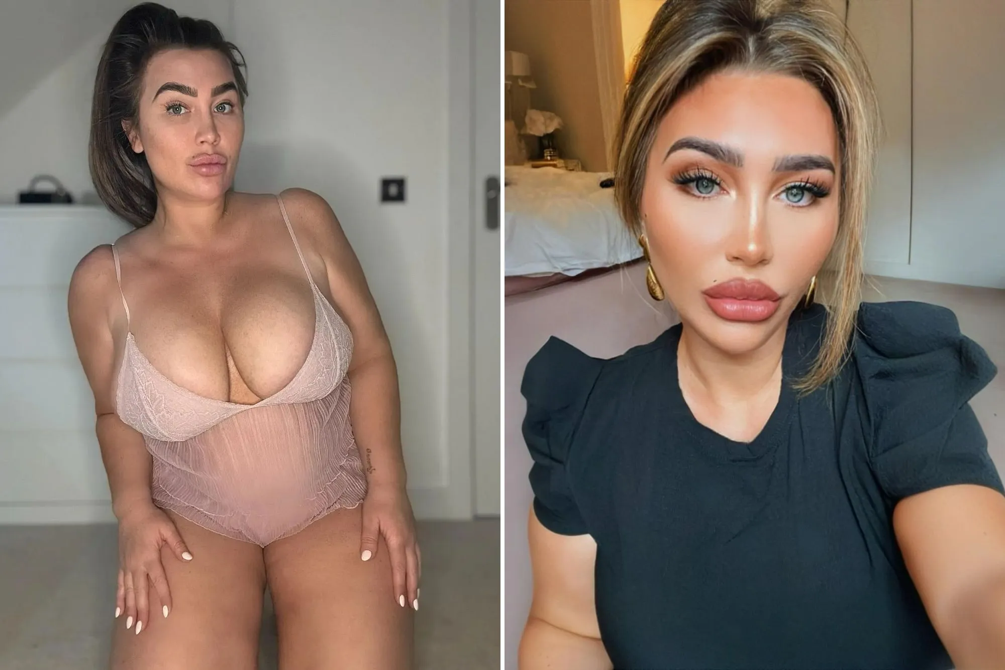 Lauren Goodger Opens Up: Why She's Reversing Surgery for a Natural Look